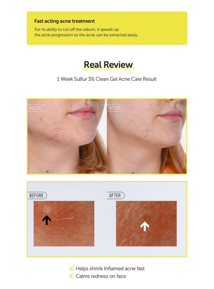 sulfur-3-clean-gel-30g