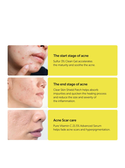 sulfur-3-clean-gel-30g