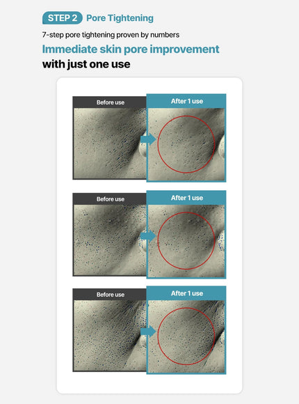 Galacto Pore Serum (40ml)